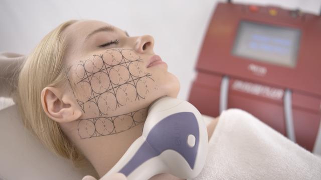 脂肪型发腮了还能变回去吗，20岁发腮了还能变回去吗