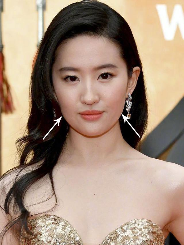 脂肪型发腮了还能变回去吗，20岁发腮了还能变回去吗