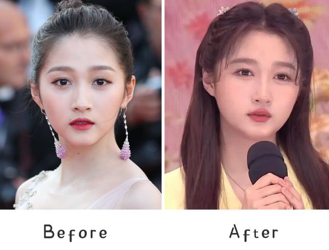 脂肪型发腮了还能变回去吗，20岁发腮了还能变回去吗