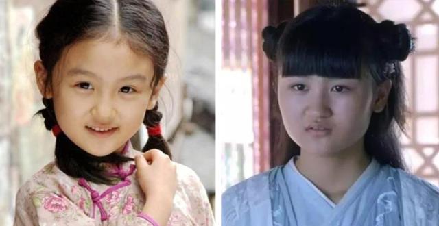 脂肪型发腮了还能变回去吗，20岁发腮了还能变回去吗