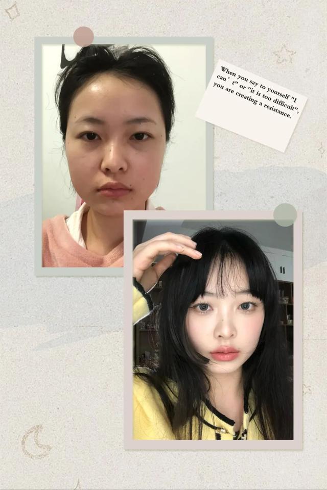 脂肪型发腮了还能变回去吗，20岁发腮了还能变回去吗