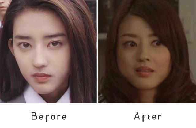 脂肪型发腮了还能变回去吗，20岁发腮了还能变回去吗