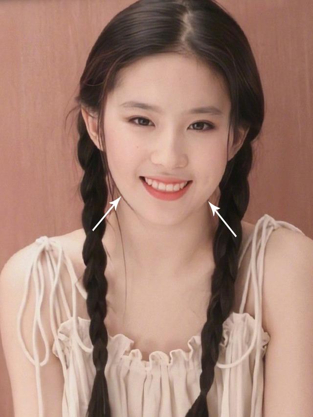 脂肪型发腮了还能变回去吗，20岁发腮了还能变回去吗