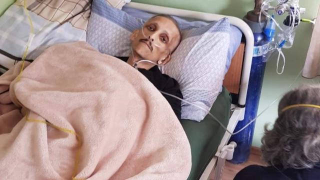 自残最不痛的方法（自残不疼的十种方法）