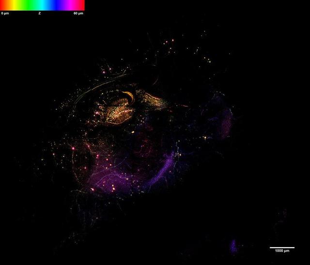 光学显微镜,光学显微镜和电子显微镜的区别