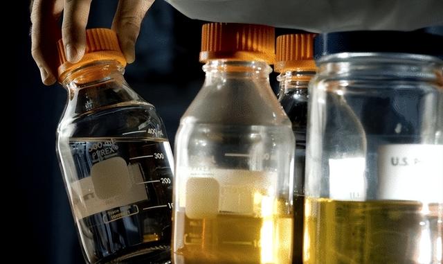 一吨尿可以提取多少尿激酶,尿激酶提炼设备一套得多少钱